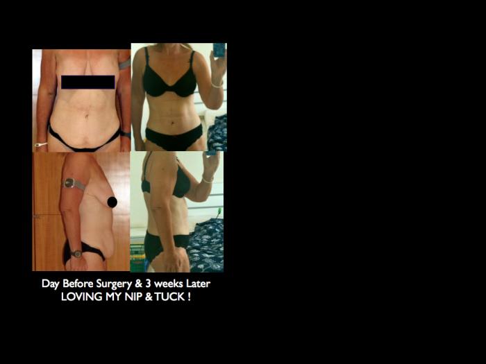 3 Weeks - Nip & Tuck 3 Weeks - Nip & Tuck